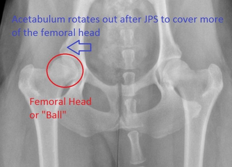 JPS-leikkauksen röntgenkuva